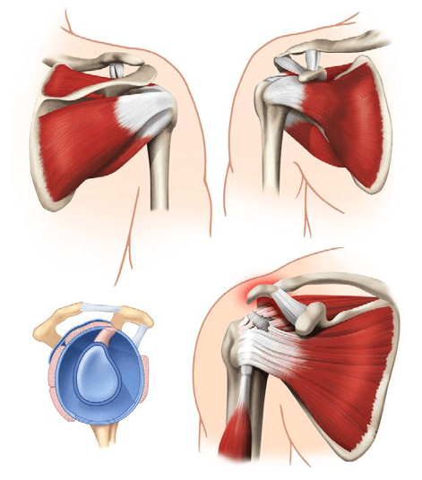 shoulder-rotator-cuff