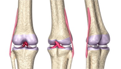peroneal-knee